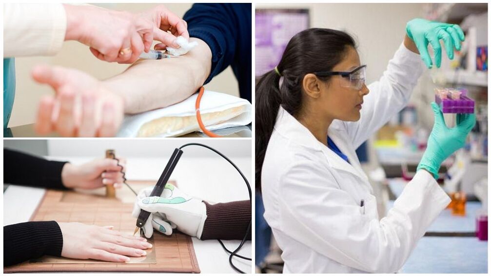 Diagnostické metody k detekci parazitů v těle