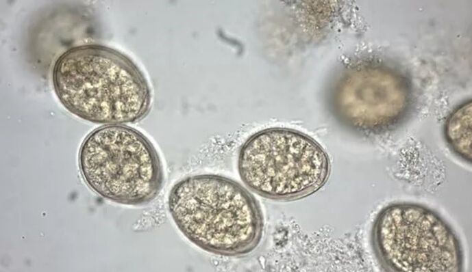 parazity pod mikroskopem