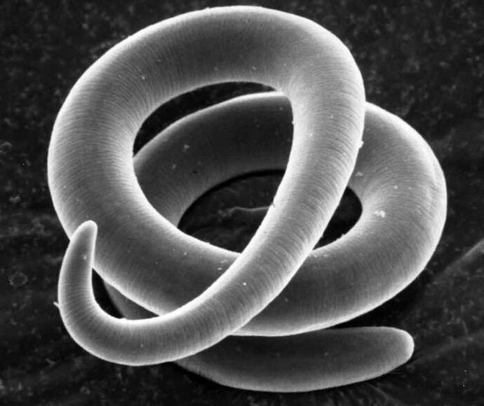Trichinella pod mikroskopem